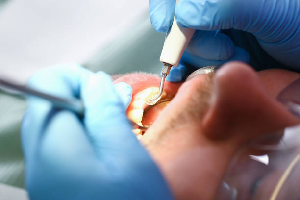 Best Walk-In Emergency Dental Services in Hudson Bend, TX